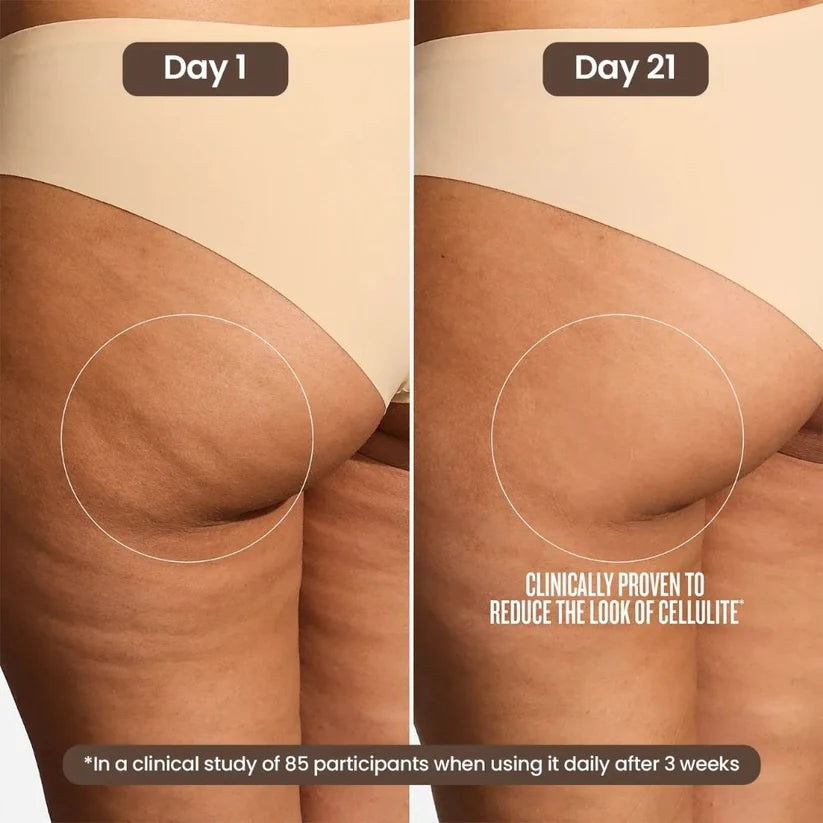 Zenova Anti-Cellulite Firming Gel